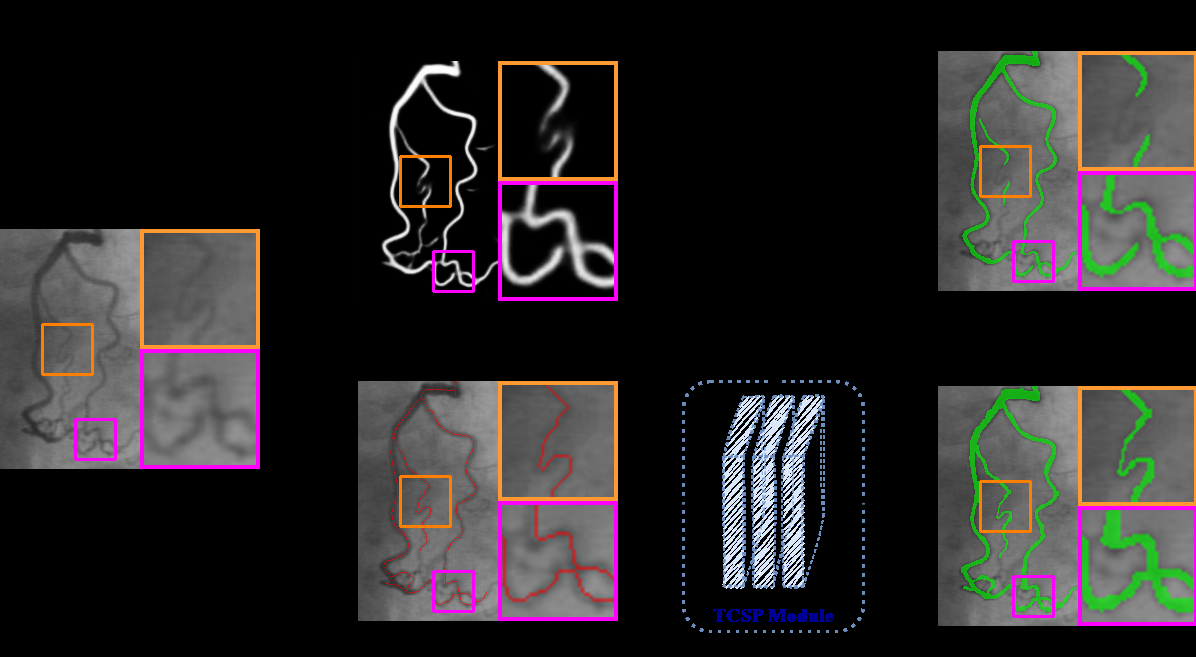 Continuous-tone Simple Points: An $ll_0$-Norm of Cyclic Gradient for Topology-Preserving Data-Driven Image Segmentation