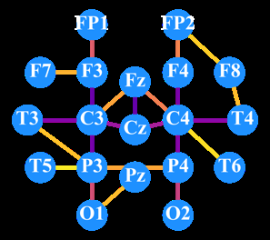 Fig 4