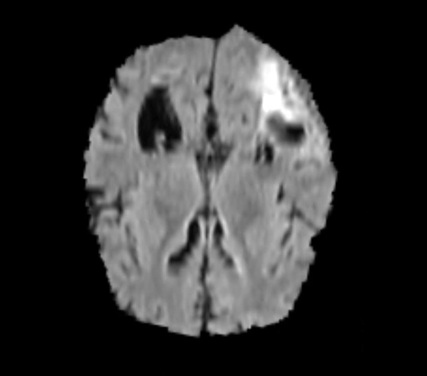Fig 1