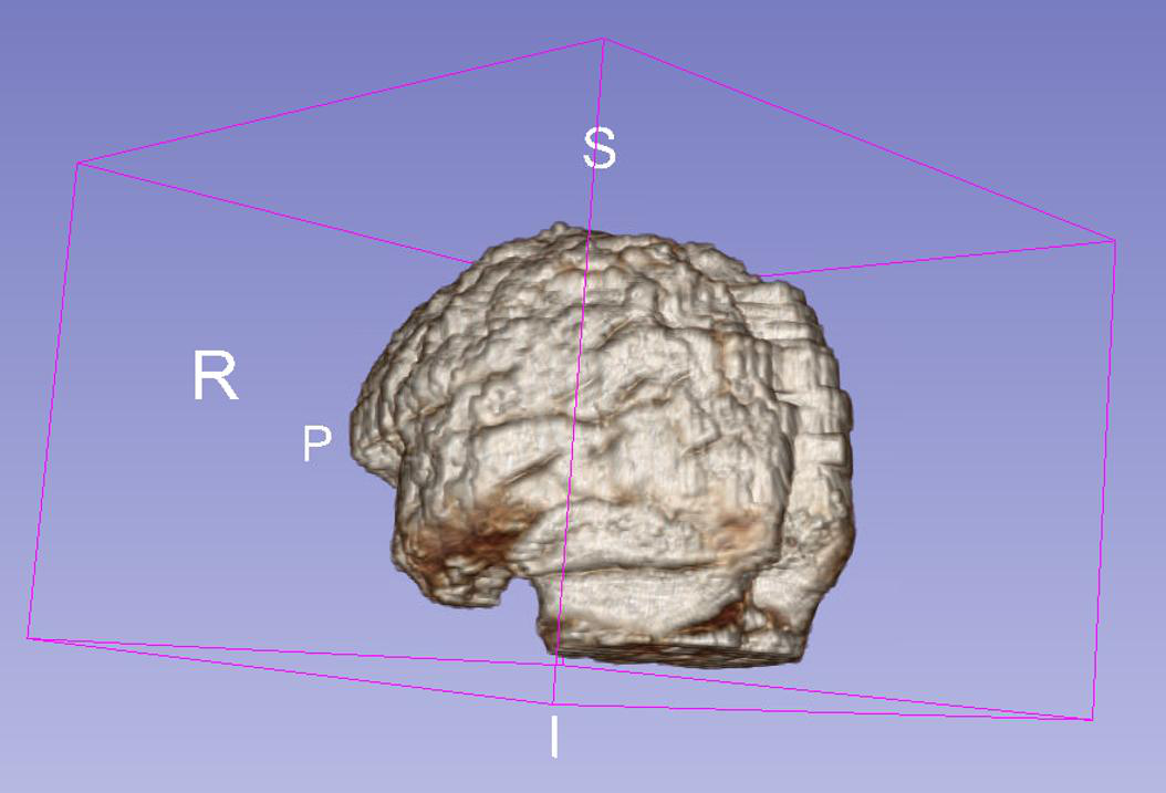 Fig 4