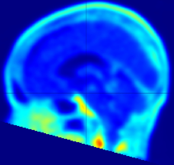 Fig 1