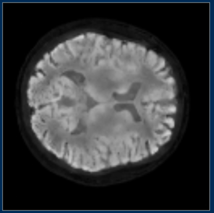 Fig 8