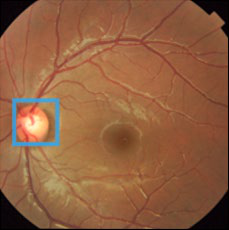 Fig 4