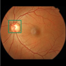 Fig 5