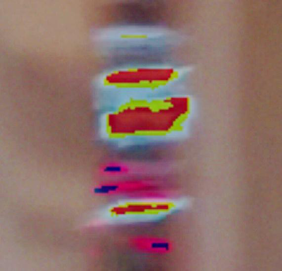 Fig 8
