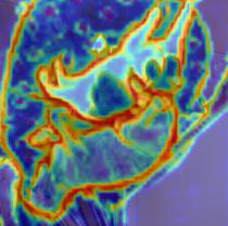 Fig 3
