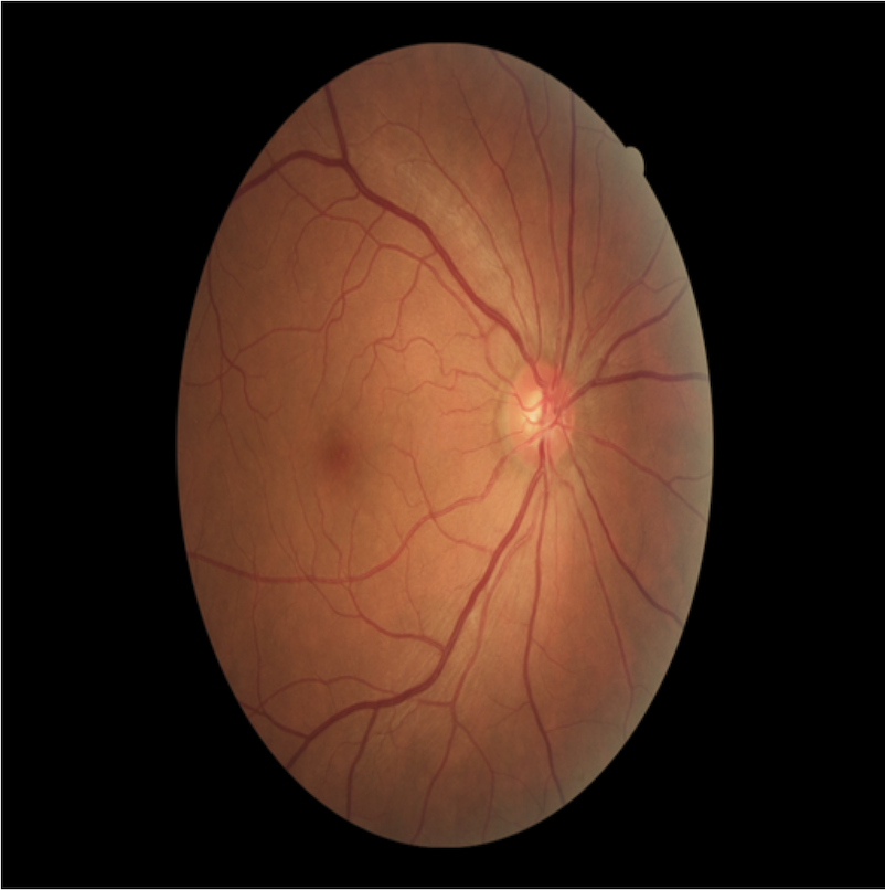 Fig 1