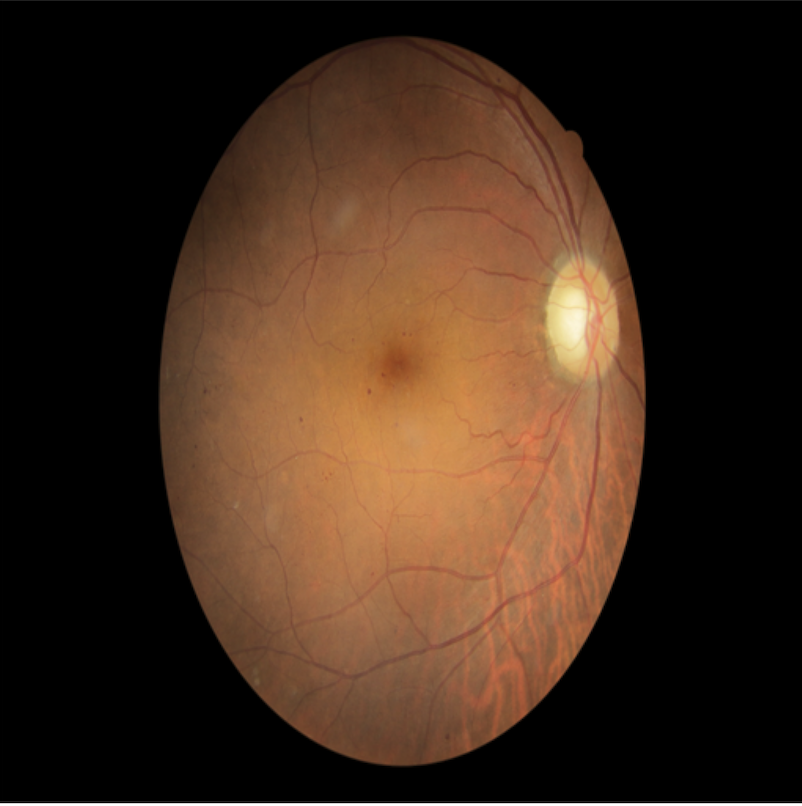 Fig 2