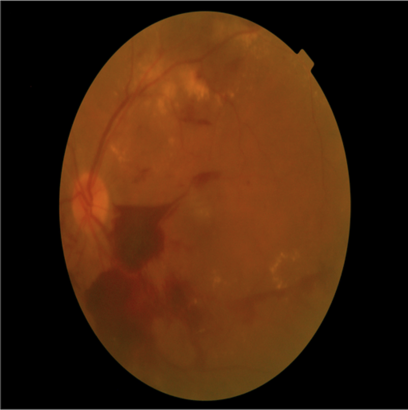 Fig 3