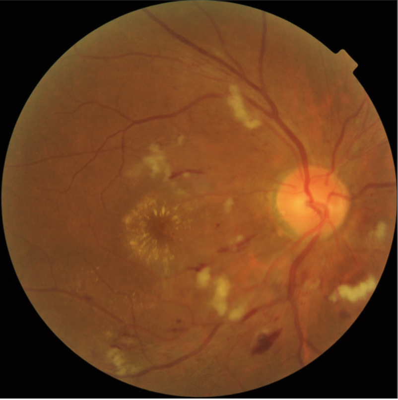 Fig 4