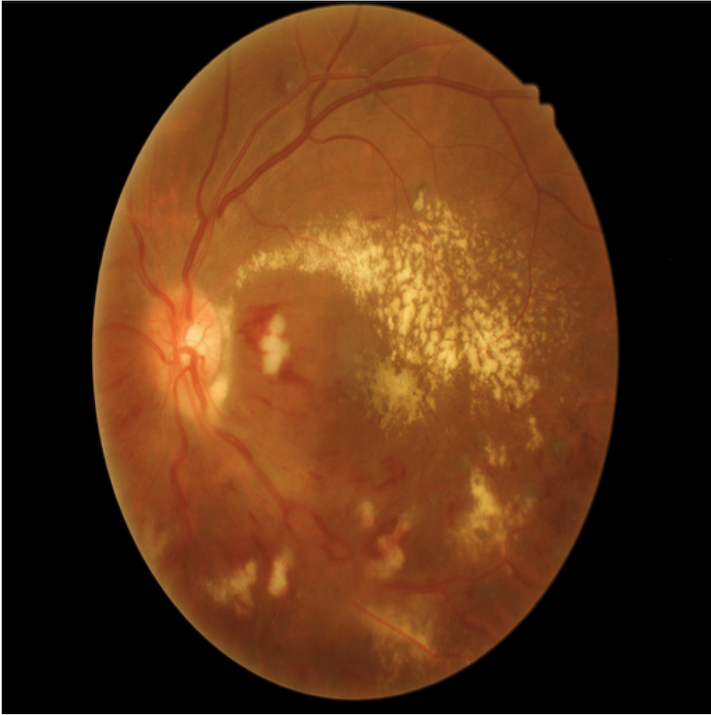 Fig 5