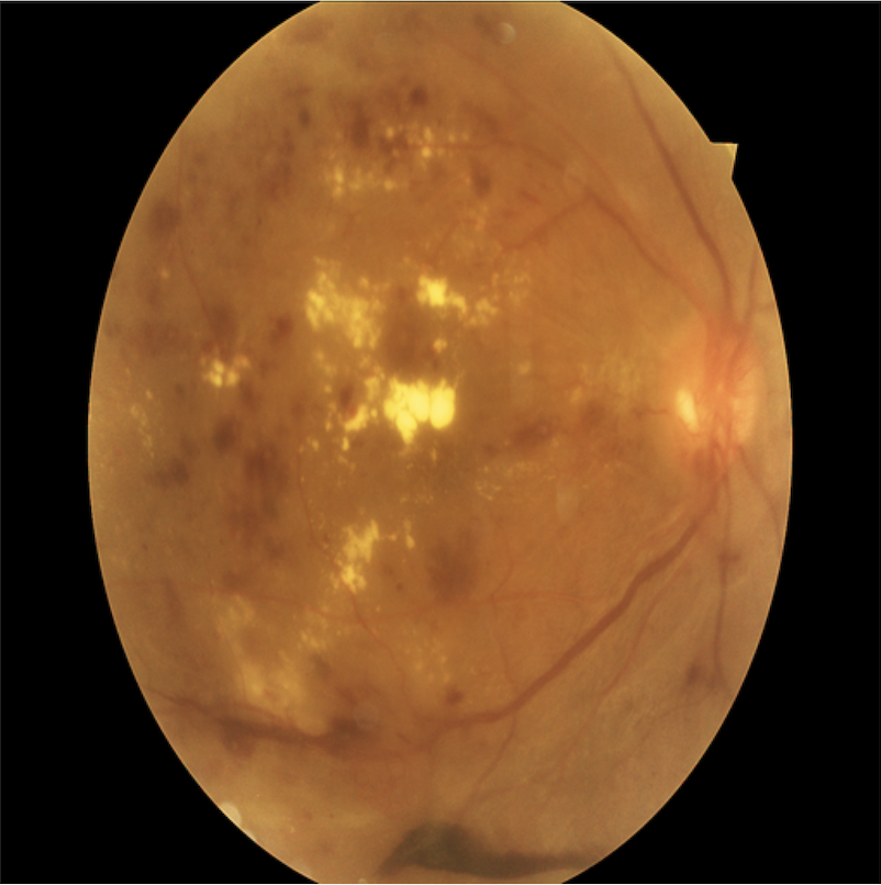 Fig 6