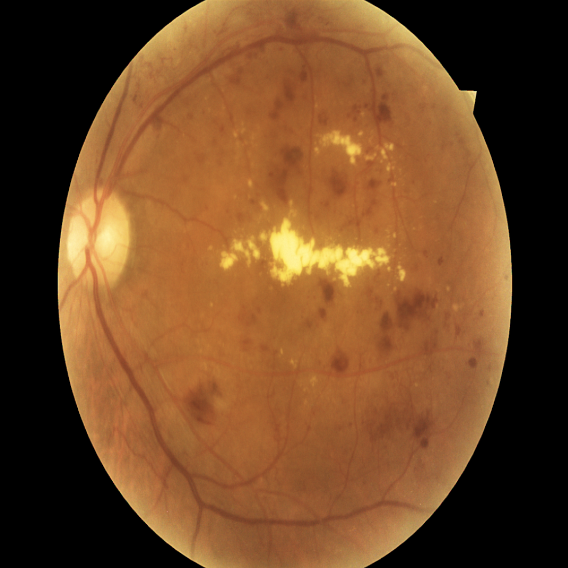 Fig 3