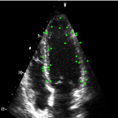 Fig 4