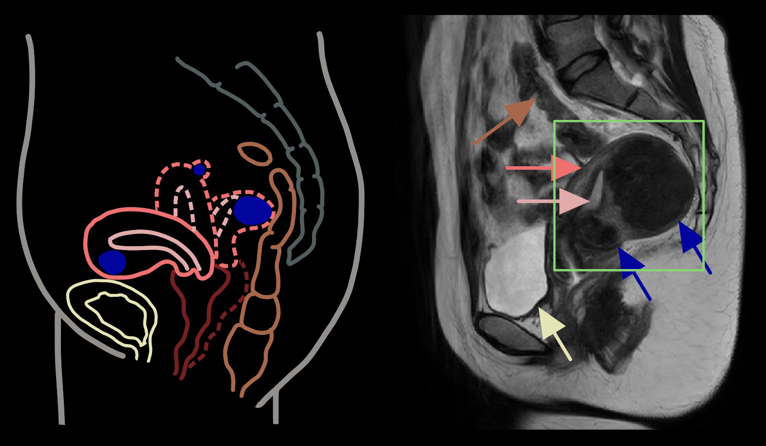 Panda: Unsupervised Pelvic Anomaly Detection for Real-Time MR Imaging